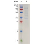 SDS-PAGE - Recombinant Human Claudin 2 Protein (Fc Tag) (A317993) - Antibodies.com
