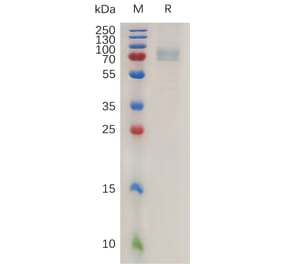 SDS-PAGE - Recombinant Human CD19 Protein (Fc Tag) (A317994) - Antibodies.com