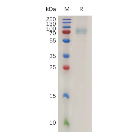 SDS-PAGE - Recombinant Human CD19 Protein (Fc Tag) (A317994) - Antibodies.com