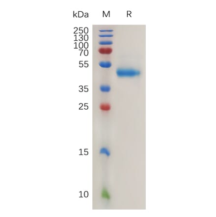 SDS-PAGE - Recombinant Human RSPO1 Protein (Fc Tag) (A317995) - Antibodies.com