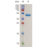 SDS-PAGE - Recombinant Human RSPO1 Protein (Fc Tag) (A317995) - Antibodies.com