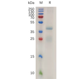 SDS-PAGE - Recombinant Human RSPO1 Protein (6×His Tag) (A317996) - Antibodies.com