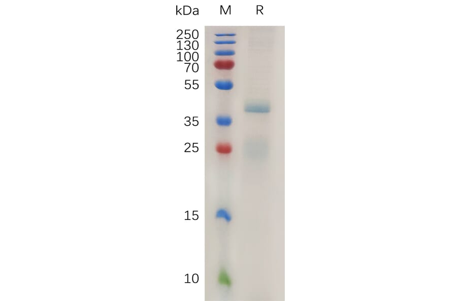 SDS-PAGE - Recombinant Human RSPO1 Protein (6×His Tag) (A317996) - Antibodies.com