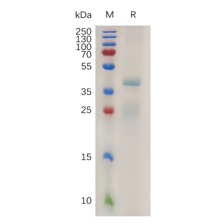SDS-PAGE - Recombinant Human RSPO1 Protein (6×His Tag) (A317996) - Antibodies.com
