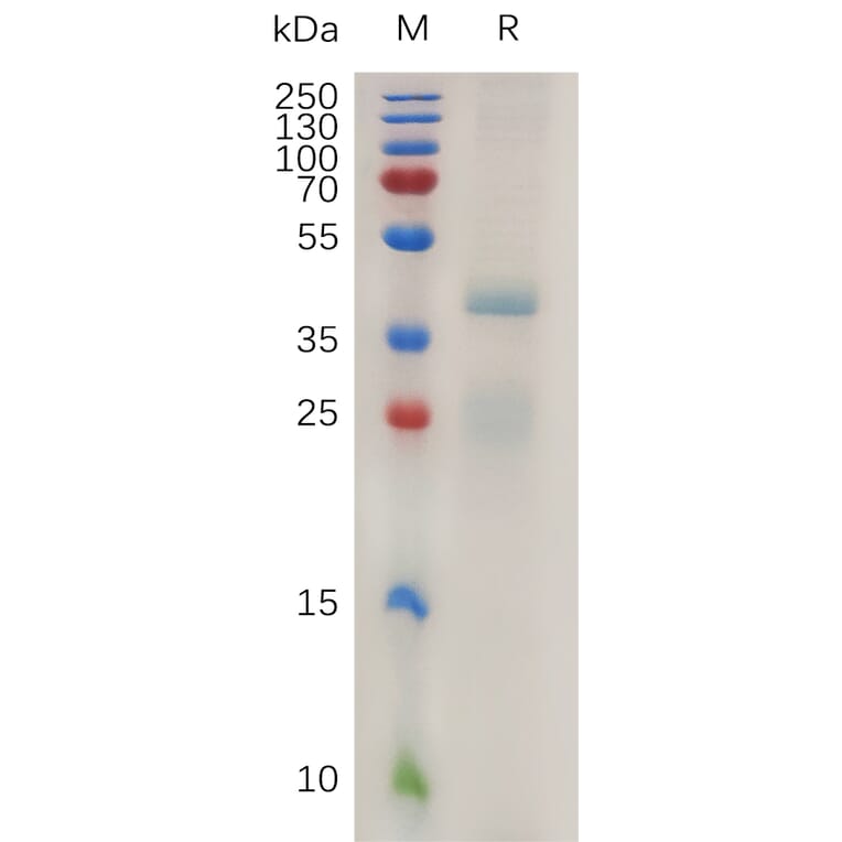 SDS-PAGE - Recombinant Human RSPO1 Protein (6×His Tag) (A317996) - Antibodies.com