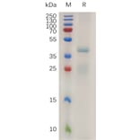 SDS-PAGE - Recombinant Human RSPO1 Protein (6×His Tag) (A317996) - Antibodies.com