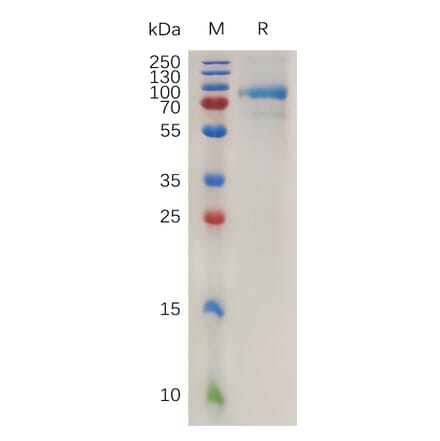 SDS-PAGE - Recombinant Human Quiescin Q6 Protein (6×His Tag) (A317997) - Antibodies.com