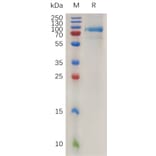 SDS-PAGE - Recombinant Human Quiescin Q6 Protein (6×His Tag) (A317997) - Antibodies.com