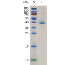 SDS-PAGE - Recombinant Human TGF beta Receptor I Protein (Fc Tag) (A317998) - Antibodies.com