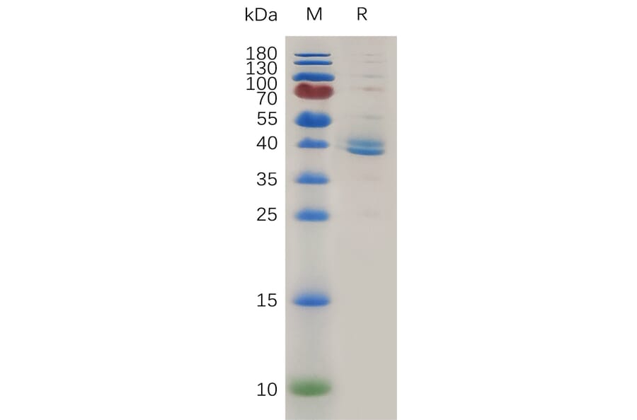 SDS-PAGE - Recombinant Human TGF beta Receptor I Protein (Fc Tag) (A317998) - Antibodies.com