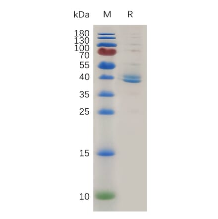SDS-PAGE - Recombinant Human TGF beta Receptor I Protein (Fc Tag) (A317998) - Antibodies.com