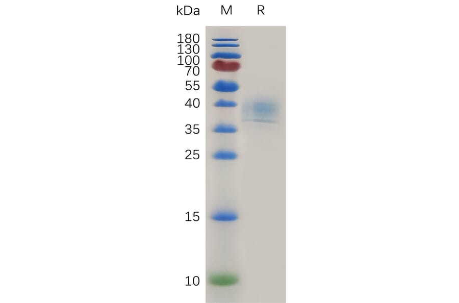 SDS-PAGE - Recombinant Human CD52 Protein (Fc Tag) (A317999) - Antibodies.com