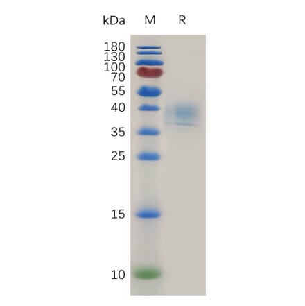 SDS-PAGE - Recombinant Human CD52 Protein (Fc Tag) (A317999) - Antibodies.com
