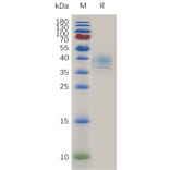 SDS-PAGE - Recombinant Human CD52 Protein (Fc Tag) (A317999) - Antibodies.com