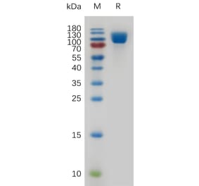 SDS-PAGE - Recombinant Human VCAM1 Protein (6×His Tag) (A318000) - Antibodies.com