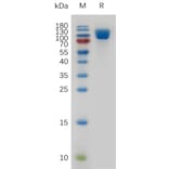 SDS-PAGE - Recombinant Human VCAM1 Protein (6×His Tag) (A318000) - Antibodies.com