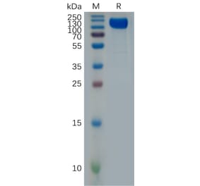 SDS-PAGE - Recombinant Human Interferon alpha/beta Receptor 1 Protein (Fc Tag) (A318001) - Antibodies.com