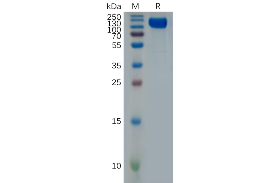 SDS-PAGE - Recombinant Human Interferon alpha/beta Receptor 1 Protein (Fc Tag) (A318001) - Antibodies.com