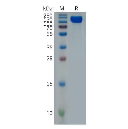 SDS-PAGE - Recombinant Human Interferon alpha/beta Receptor 1 Protein (Fc Tag) (A318001) - Antibodies.com