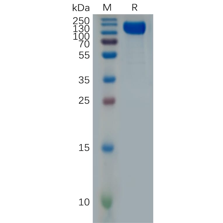 SDS-PAGE - Recombinant Human Interferon alpha/beta Receptor 1 Protein (Fc Tag) (A318001) - Antibodies.com