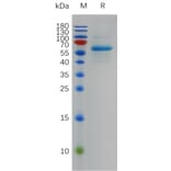 SDS-PAGE - Recombinant SARS-CoV-2 Spike Glycoprotein RBD (Omicron BA.2 Variant) (Fc Tag) (A318002) - Antibodies.com