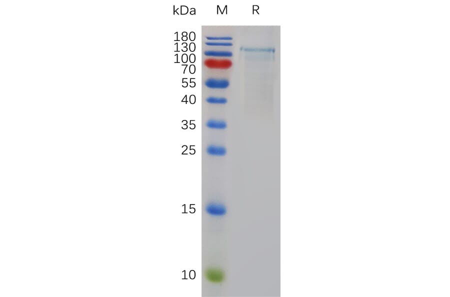 SDS-PAGE - Recombinant Human ADAMTS1 Protein (6×His Tag) (A318003) - Antibodies.com