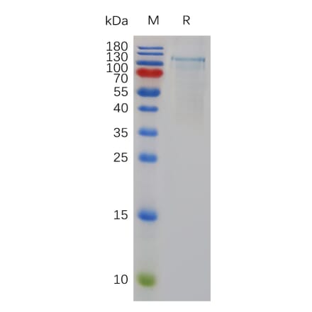 SDS-PAGE - Recombinant Human ADAMTS1 Protein (6×His Tag) (A318003) - Antibodies.com