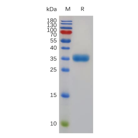 SDS-PAGE - Recombinant Human Mast Cell Tryptase Protein (6×His Tag) (A318004) - Antibodies.com