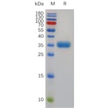 SDS-PAGE - Recombinant Human Mast Cell Tryptase Protein (6×His Tag) (A318004) - Antibodies.com