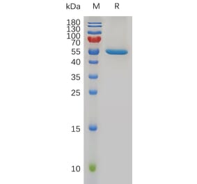 SDS-PAGE - Recombinant Human FGF21 Protein (Fc Tag) (A318005) - Antibodies.com