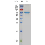 SDS-PAGE - Recombinant Human FGF21 Protein (Fc Tag) (A318005) - Antibodies.com