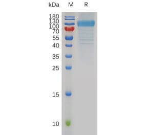 SDS-PAGE - Recombinant Human HHLA2 Protein (Fc Tag) (A318006) - Antibodies.com