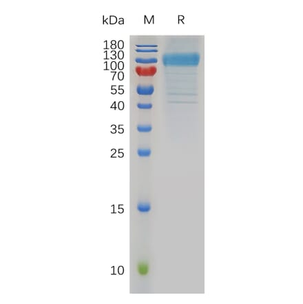 SDS-PAGE - Recombinant Human HHLA2 Protein (Fc Tag) (A318006) - Antibodies.com