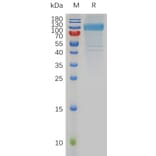 SDS-PAGE - Recombinant Human HHLA2 Protein (Fc Tag) (A318006) - Antibodies.com