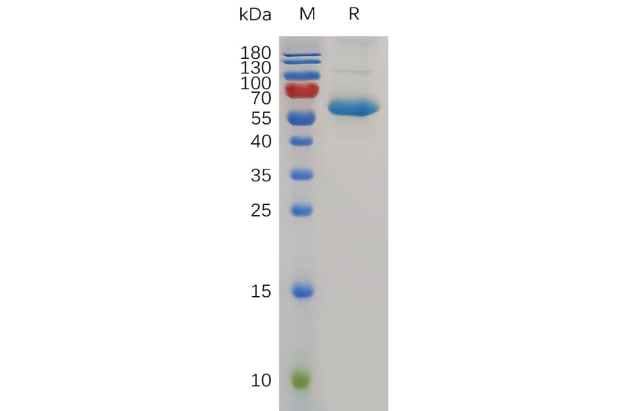 SDS-PAGE - Recombinant Human CD72 Protein (Fc Tag) (A318007) - Antibodies.com