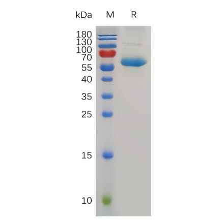 SDS-PAGE - Recombinant Human CD72 Protein (Fc Tag) (A318007) - Antibodies.com
