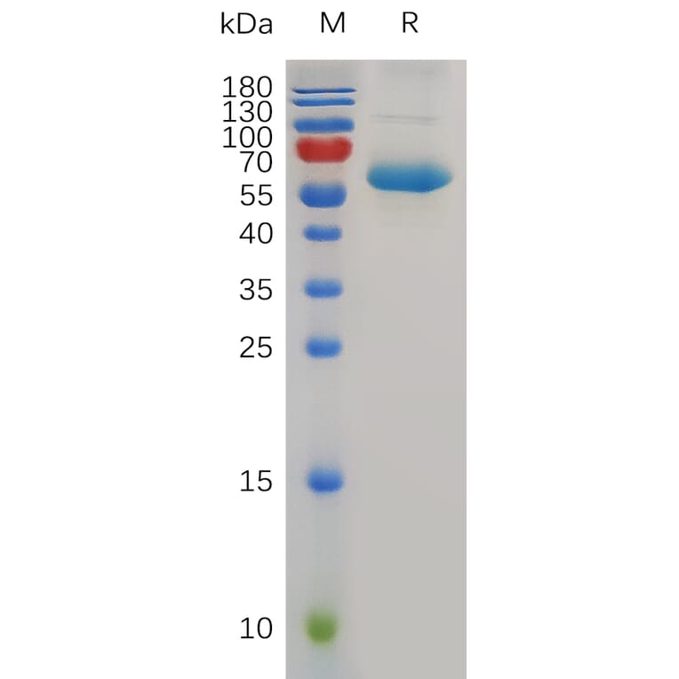 SDS-PAGE - Recombinant Human CD72 Protein (Fc Tag) (A318007) - Antibodies.com