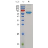 SDS-PAGE - Recombinant Human CD72 Protein (Fc Tag) (A318007) - Antibodies.com
