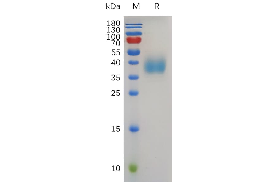 SDS-PAGE - Recombinant Human TROP2 Protein (6×His Tag) (A318008) - Antibodies.com