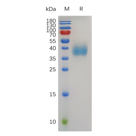 SDS-PAGE - Recombinant Human TROP2 Protein (6×His Tag) (A318008) - Antibodies.com
