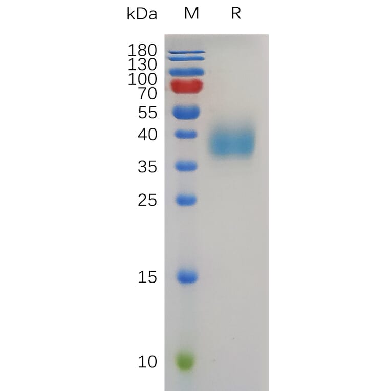 SDS-PAGE - Recombinant Human TROP2 Protein (6×His Tag) (A318008) - Antibodies.com