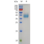 SDS-PAGE - Recombinant Human TROP2 Protein (6×His Tag) (A318008) - Antibodies.com