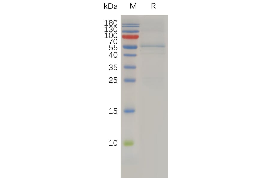 SDS-PAGE - Recombinant Human TIMP4 Protein (Fc Tag) (A318009) - Antibodies.com
