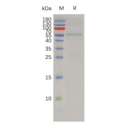 SDS-PAGE - Recombinant Human TIMP4 Protein (Fc Tag) (A318009) - Antibodies.com