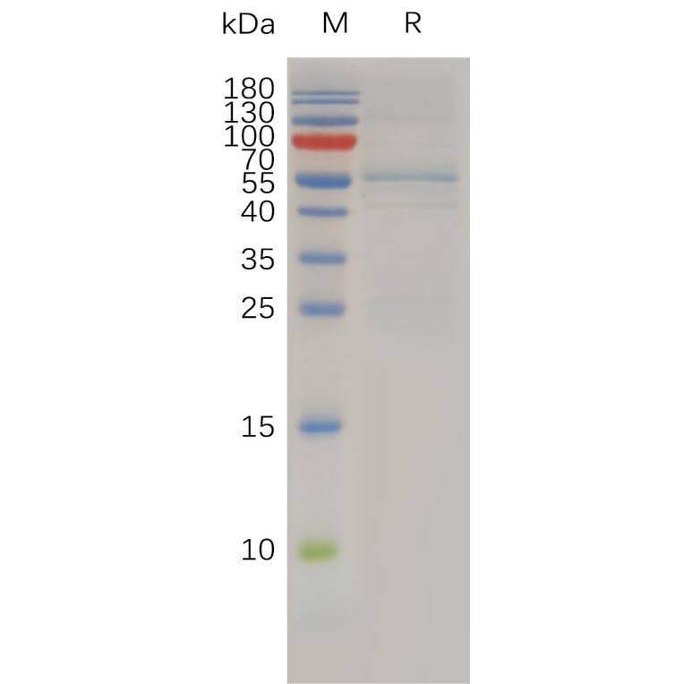 SDS-PAGE - Recombinant Human TIMP4 Protein (Fc Tag) (A318009) - Antibodies.com