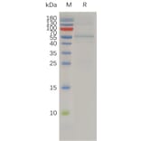 SDS-PAGE - Recombinant Human TIMP4 Protein (Fc Tag) (A318009) - Antibodies.com