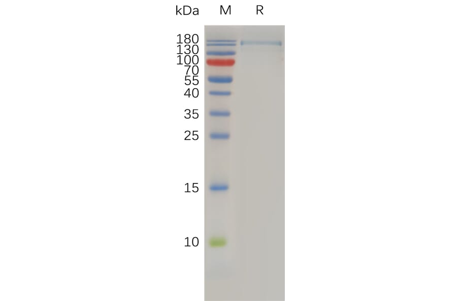 SDS-PAGE - Recombinant Human CD11c Protein (6xHis Tag) + CD18 Protein (Fc Tag) Heterodimer (A318010) - Antibodies.com