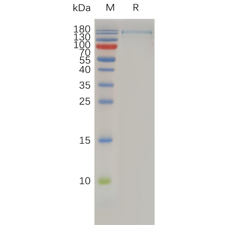 SDS-PAGE - Recombinant Human CD11c Protein (6xHis Tag) + CD18 Protein (Fc Tag) Heterodimer (A318010) - Antibodies.com