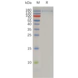 SDS-PAGE - Recombinant Human CD11c Protein (6xHis Tag) + CD18 Protein (Fc Tag) Heterodimer (A318010) - Antibodies.com