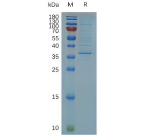SDS-PAGE - Recombinant Human Claudin 5 Protein (Fc Tag) (A318011) - Antibodies.com